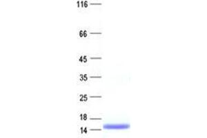 SPINK8 Protein (His tag)