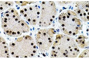 Immunohistochemistry of paraffin-embedded Human stomach using EIF4G2 Polyclonal Antibody (EIF4G2 antibody)