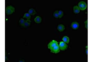 Immunofluorescent analysis of MCF-7 cells using ABIN7161014 at dilution of 1:100 and Alexa Fluor 488-congugated AffiniPure Goat Anti-Rabbit IgG(H+L) (NOX5 antibody  (AA 661-765))