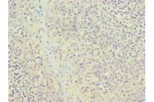 NUTF2 antibody  (AA 1-127)