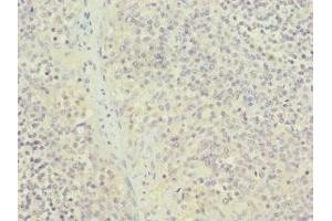 Immunohistochemistry of paraffin-embedded human tonsil tissue using ABIN7161949 at dilution of 1:100 (NUTF2 antibody  (AA 1-127))