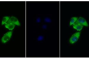 Detection of GCSFR in Human MCF7 cell using Polyclonal Antibody to Colony Stimulating Factor Receptor, Granulocyte (GCSFR) (CSF3R antibody  (AA 26-138))