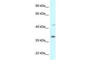 Image no. 1 for anti-Bone Marrow Stromal Cell Antigen 1 (BST1) (AA 108-157) antibody (ABIN6747338) (BST1 antibody  (AA 108-157))