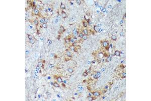 Immunohistochemistry of paraffin-embedded Mouse brain using GRSF1 Rabbit pAb (ABIN7267319) at dilution of 1:100 (40x lens).