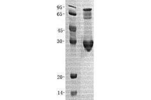 Validation with Western Blot (CLIC5 Protein (Transcript Variant 1) (His tag))
