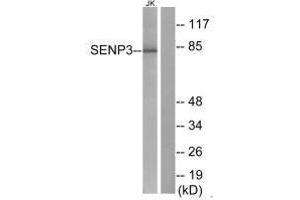 Western blot analysis of extracts from Jurkat cells, using SENP3 antibody. (SENP3 antibody)