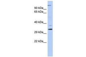 Image no. 1 for anti-Actin Related Protein 2/3 Complex, Subunit 2, 34kDa (ARPC2) (N-Term) antibody (ABIN6741467) (ARPC2 antibody  (N-Term))