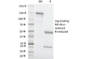SDS-PAGE Analysis Purified CEA Mouse Monoclonal Antibody (C66/1260). (CEACAM5 antibody)