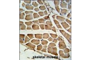Formalin-fixed and paraffin-embedded human skeletal muscle tissue reacted with CARD4 Antibody (C-term), which was peroxidase-conjugated to the secondary antibody, followed by DAB staining. (NOD1 antibody  (C-Term))