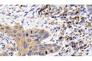 Immunohistochemistry (IHC) image for anti-BCL2-Like 11 (Apoptosis Facilitator) (BCL2L11) (AA 2-120) antibody (ABIN7430234)