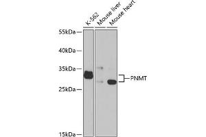 Western blot analysis of extracts of various cell lines, using PNMT antibody (ABIN6130644, ABIN6145848, ABIN6145850 and ABIN6221200) at 1:1000 dilution. (PNMT antibody  (AA 1-282))