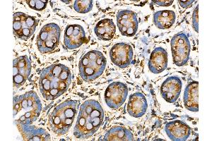 ABIN6258534 and ABIN6274806 at 1/100 staining Rat stomach tissue by IHC-P. (ACOT4 antibody  (C-Term))