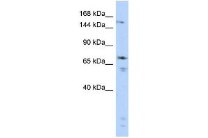 WB Suggested Anti-GRIN2B Antibody Titration:  0. (GRIN2B antibody  (Middle Region))