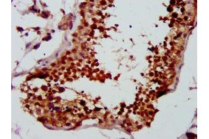 IHC image of ABIN7147315 diluted at 1:500 and staining in paraffin-embedded human testis tissue performed on a Leica BondTM system. (LYAR antibody  (AA 1-379))