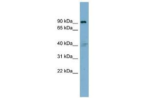 Integrin Beta 5 antibody used at 1 ug/ml to detect target protein. (Integrin beta 5 antibody  (Middle Region))