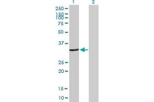 Western Blot analysis of DCK expression in transfected 293T cell line by DCK MaxPab polyclonal antibody. (DCK antibody  (AA 1-260))