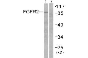 Western blot analysis of extracts from A549 cells, using FGFR2 antibody. (FGFR2 antibody  (Internal Region))