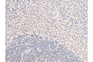 ABIN6255774 and ABIN6267285 at 1/100 staining rat spleen tissue sections by IHC-P.