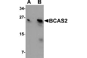 Western Blotting (WB) image for anti-Breast Carcinoma Amplified Sequence 2 (BCAS2) (C-Term) antibody (ABIN1030285) (BCAS2 antibody  (C-Term))