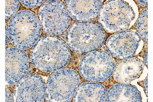 ABIN6257199 and ABIN6275956 at 1/100 staining Mouse testis tissue by IHC-P.