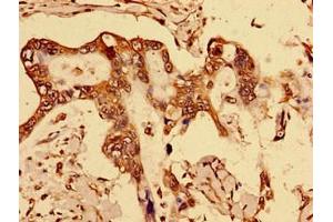Immunohistochemistry (IHC) image for anti-Docking Protein 1, 62kDa (Downstream of tyrosine Kinase 1) (DOK1) (AA 1-481) antibody (ABIN7150562)