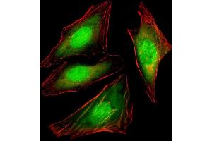 Immunofluorescent analysis of 4 % paraformaldehyde-fixed, 0. (VCP antibody)