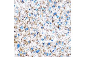 Immunohistochemistry (IHC) image for anti-Cathepsin B (CTSB) (AA 1-339) antibody (ABIN3021176)