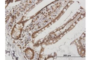 Immunoperoxidase of purified MaxPab antibody to LBR on formalin-fixed paraffin-embedded human small Intestine. (Lamin B Receptor antibody  (AA 1-615))