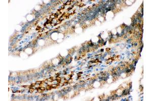 Immunohistochemistry (Paraffin-embedded Sections) (IHC (p)) image for anti-Protein Phosphatase 1, Regulatory (Inhibitor) Subunit 1B (PPP1R1B) (AA 1-36), (N-Term) antibody (ABIN3044534)