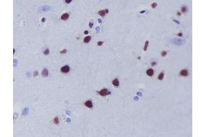 Immunohistochemistry (Paraffin-embedded Sections) (IHC (p)) image for anti-Histone Deacetylase 9 (HDAC9) antibody (ABIN7606922)