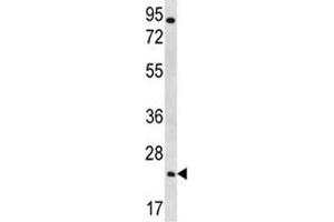 AQP5 antibody western blot analysis in NCI-H292 lysate (Aquaporin 5 antibody  (AA 227-256))