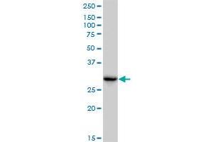 CBR3 monoclonal antibody (M05), clone 1G8. (CBR3 antibody  (AA 180-277))