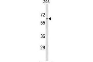 Western blot analysis of DOLK Antibody (Center) in 293 cell line lysates (35ug/lane). (Dolichol Kinase antibody  (AA 318-348))