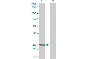 Western Blot analysis of PCTP expression in transfected 293T cell line by PCTP monoclonal antibody (M01A), clone 1F9.