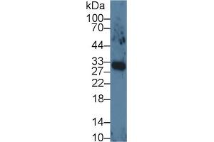 Detection of VEGF165 in Human Lung lysate using Monoclonal Antibody to Vascular Endothelial Growth Factor 165 (VEGF165) (VEGF 165 (AA 28-191) antibody)