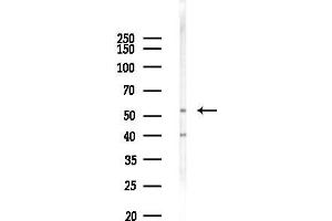 anti-Pre-mRNA Processing Factor 19 (PRPF19) (N-Term) antibody