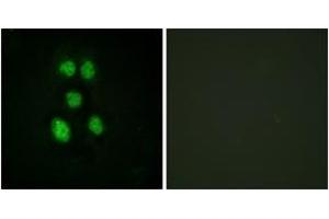 Immunofluorescence analysis of HeLa cells, using VAV1 (Ab-160) Antibody.