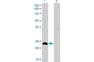 Western Blot analysis of NFYB expression in transfected 293T cell line by NFYB monoclonal antibody (M01), clone 6H6.