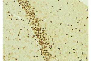 ABIN6276541 at 1/100 staining Mouse brain tissue by IHC-P.