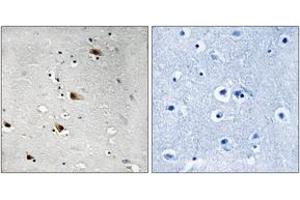 Immunohistochemistry analysis of paraffin-embedded human brain, using E2A (Phospho-Thr355) Antibody. (TCF3 antibody  (pThr355))