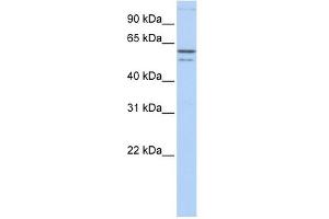 CRMP1 antibody used at 1 ug/ml to detect target protein. (CRMP1 antibody  (N-Term))
