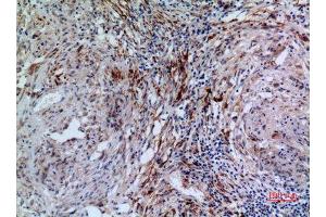 Immunohistochemistry (IHC) analysis of paraffin-embedded Human Lung, antibody was diluted at 1:100. (17beta-HSD4 (N-Term) antibody)