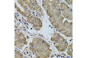 Immunohistochemistry of paraffin-embedded human stomach using CREBBP antibody (ABIN5974440) at dilution of 1/100 (40x lens). (CBP antibody)