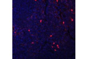 IF analysis of CXCL12 using anti-CXCL12 antibody (ABIN6719467). (CXCL12 antibody  (AA 24-93))
