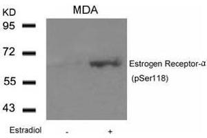 Image no. 3 for anti-Estrogen Receptor 1 (ESR1) (pSer118) antibody (ABIN196742) (Estrogen Receptor alpha antibody  (pSer118))
