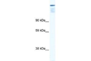 Human Muscle; WB Suggested Anti-ZFP106 Antibody Titration: 0.
