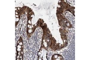 Immunohistochemical staining of human colon with NSMCE4A polyclonal antibody  shows strong cytoplasmic and membranous positivity in glandular cells at 1:50-1:200 dilution. (NSMCE4A antibody)