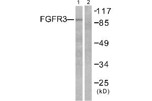 Western blot analysis of extracts from LOVO cells, using FGFR3 antibody. (FGFR3 antibody)