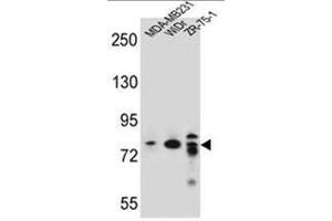 ARHGAP22 Antibody (C-term) western blot analysis in MDA-MB231,WiDr,ZR-75-1 cell line lysates (35µg/lane). (ARHGAP22 antibody  (C-Term))