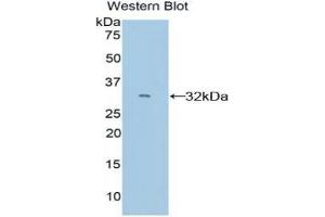 Western blot analysis of the recombinant protein. (CYP26A1 antibody  (AA 250-495))